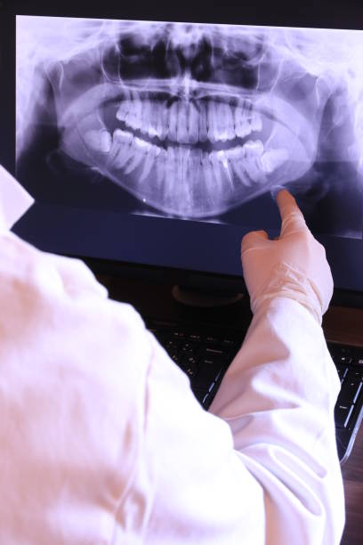 Best Emergency Tooth Extraction in Leesburg, OH