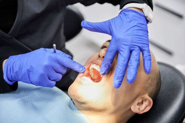 Best Emergency Tooth Extraction in Leesburg, OH